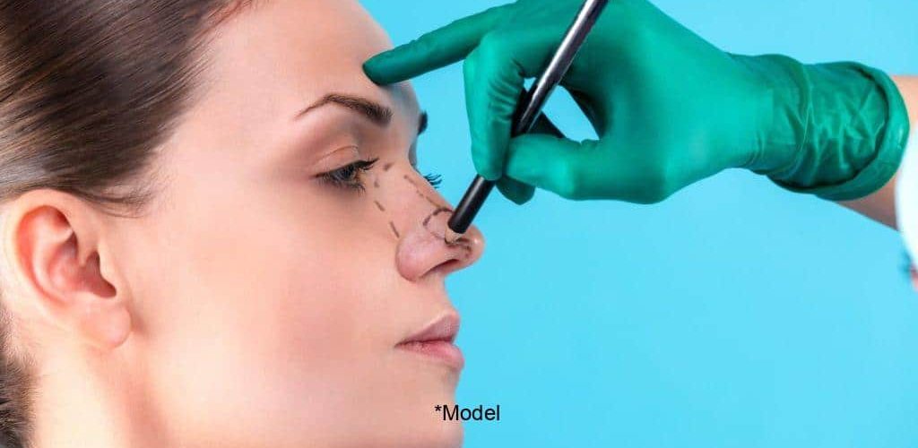 rhinoplasty for aesthetic and medical purposes 61bcddd2b877d 1024x640 1