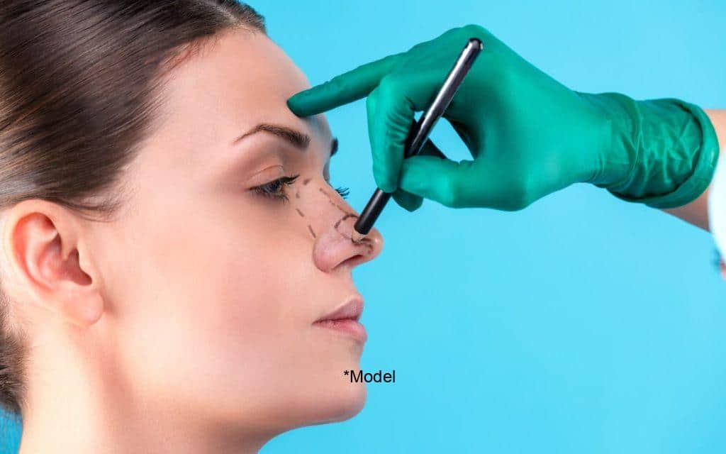 rhinoplasty for aesthetic and medical purposes 61bcddd2b877d 1024x640 1