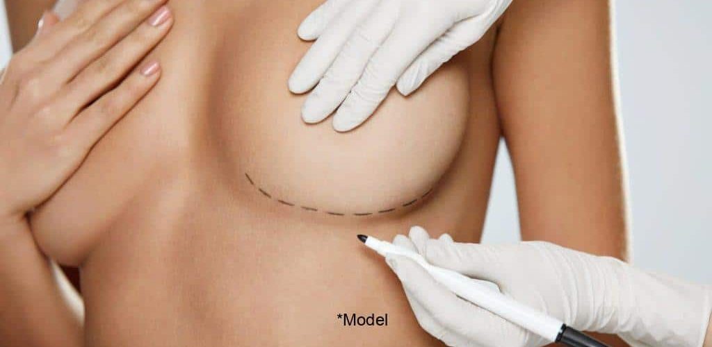 the pros and cons of receiving breast augmentation 61bcdda83c74e 1024x640 1