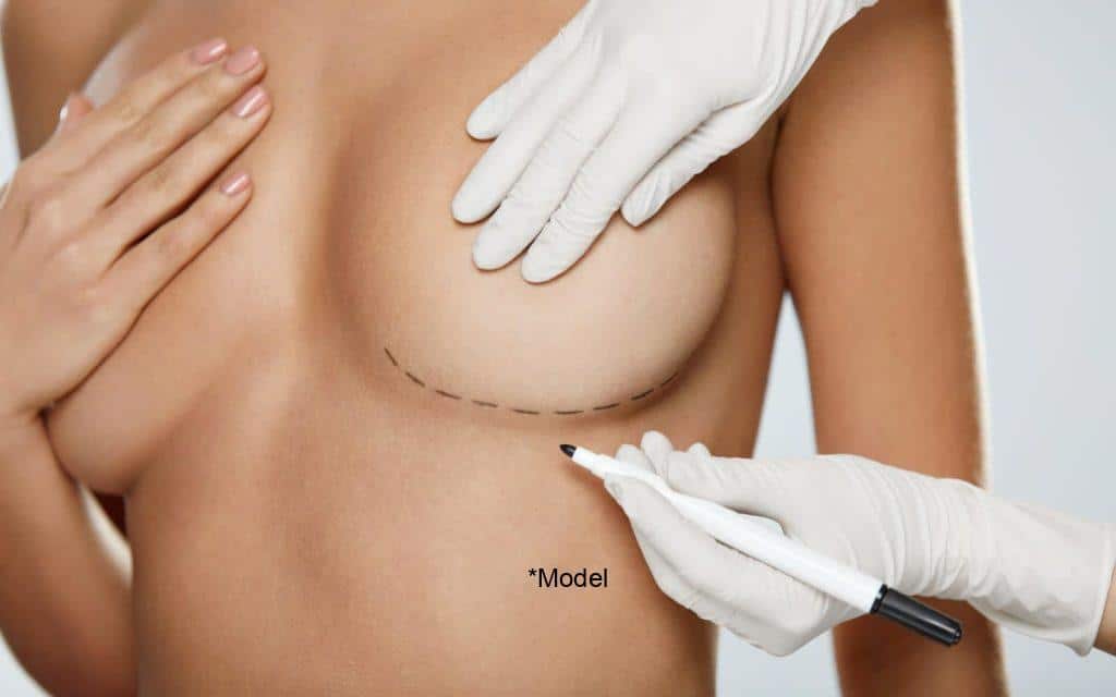 the pros and cons of receiving breast augmentation 61bcdda83c74e 1024x640 1
