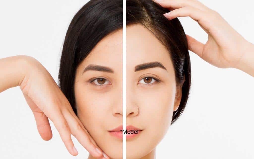 why women are diving into the world of brow lifts 61bcdda250e2d 1024x640 1