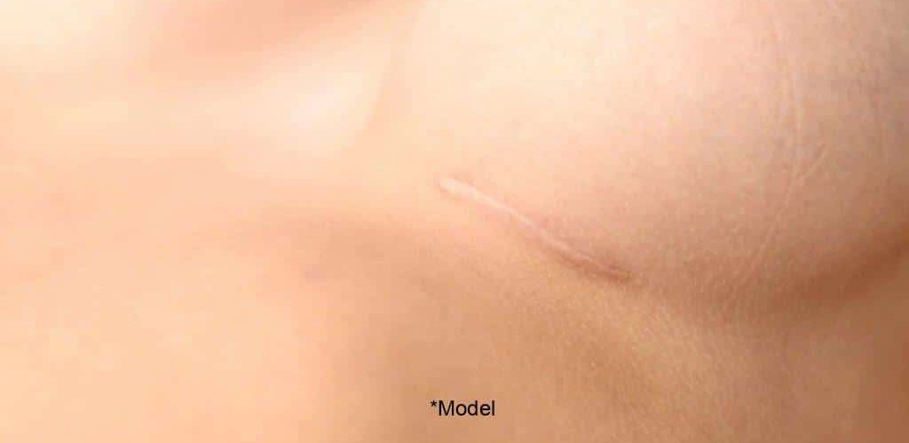 a short guide to the pros and cons of breast augmentation 61bcbe7961c3d 1024x640 1