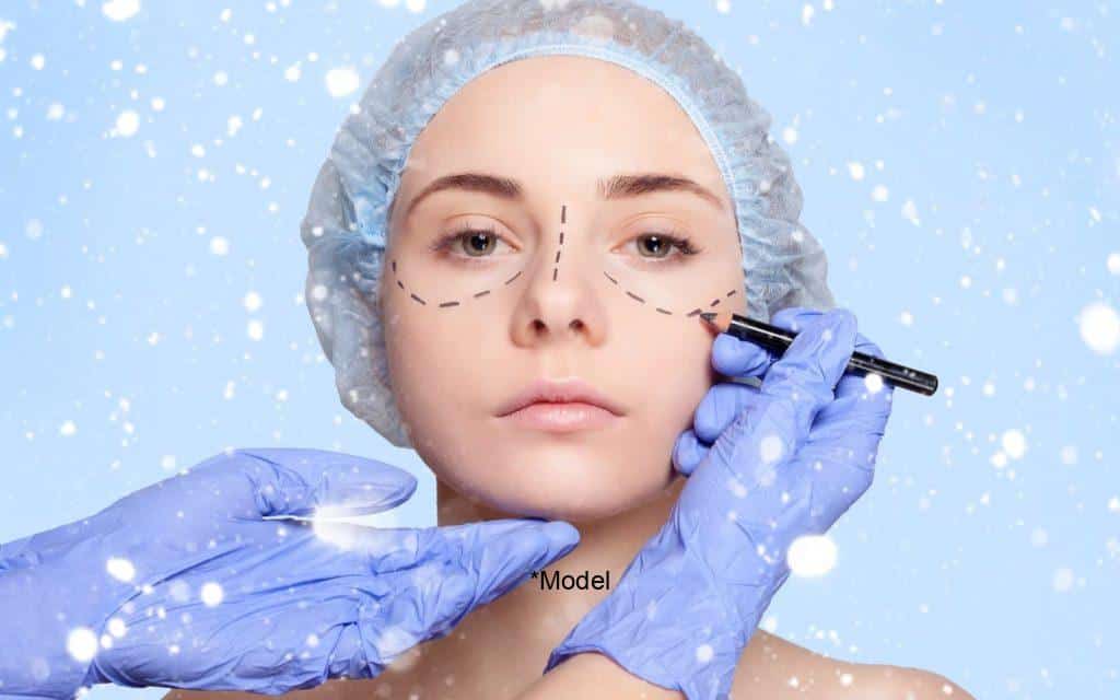 tips and tricks for getting plastic surgery for the holidays 61bcbe668a112 1024x640 1