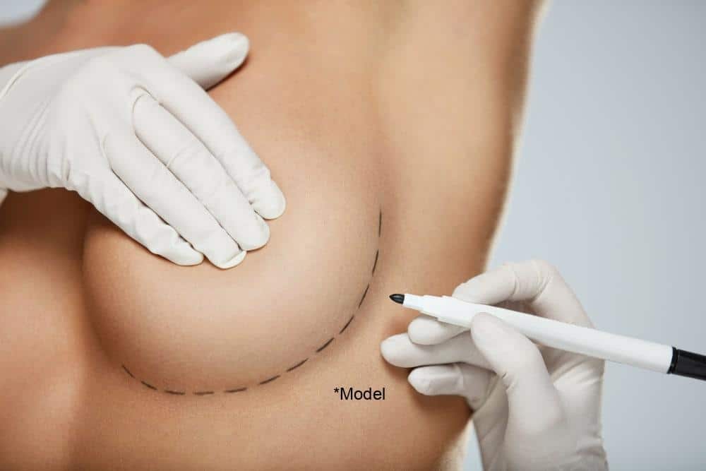 breast augmentation dr. brian pinsky babylon ny
