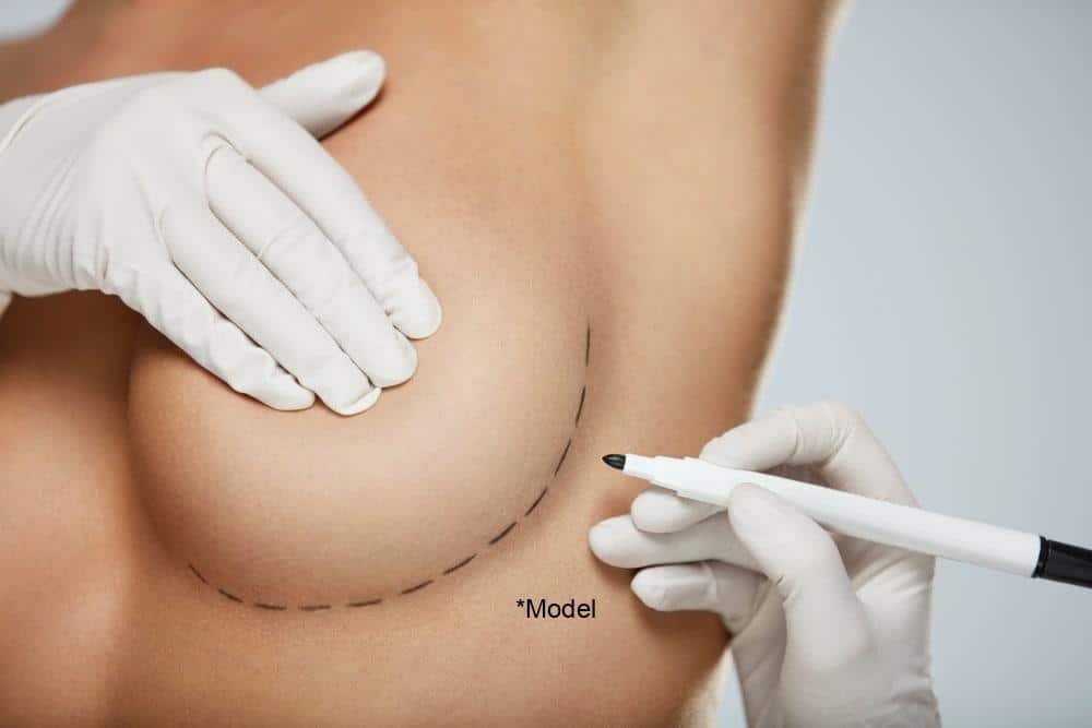A person wearing gloves uses a marker to draw a dashed line on a model's chest, indicating a curved surgical outline, as part of the meticulous planning for cosmetic procedures in Long Island. A person wearing gloves uses a marker to draw a dashed line on a model's chest, indicating a curved surgical outline, as part of the meticulous planning for cosmetic procedures in Long Island