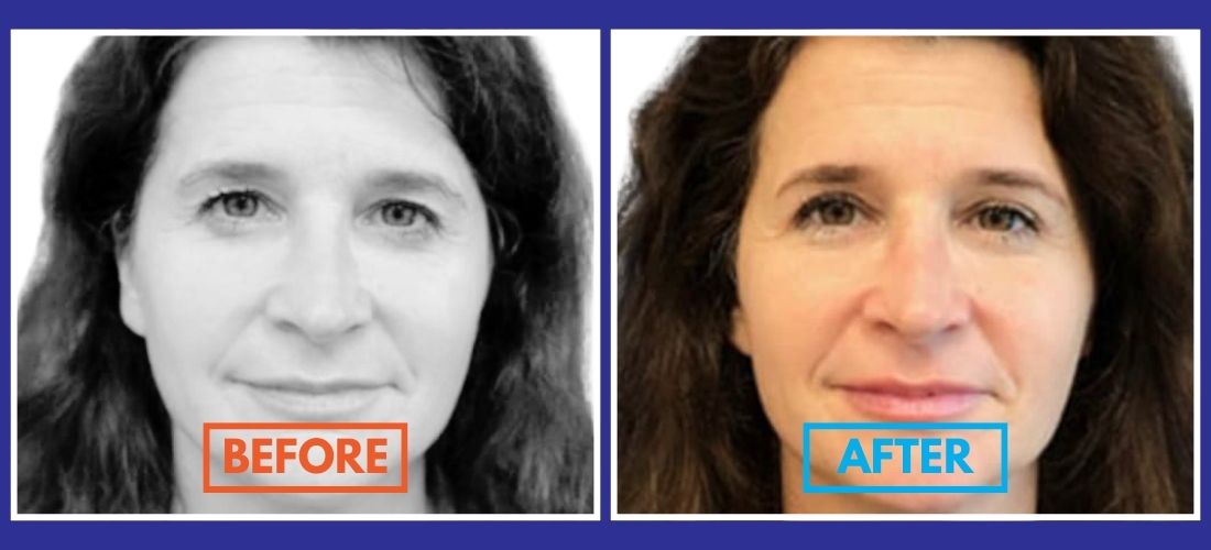 A woman is shown in two side-by-side images labeled "Before" and "After," highlighting changes in appearance.