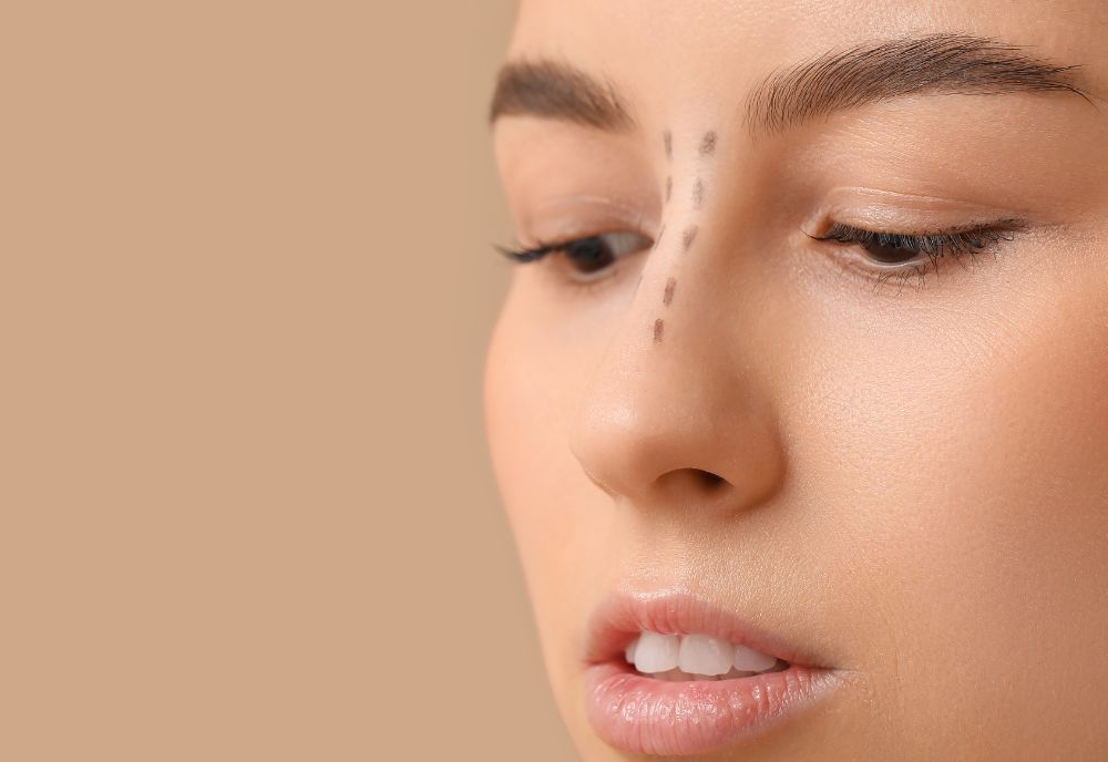 Nose Surgery (Rhinoplasty) on Long Island