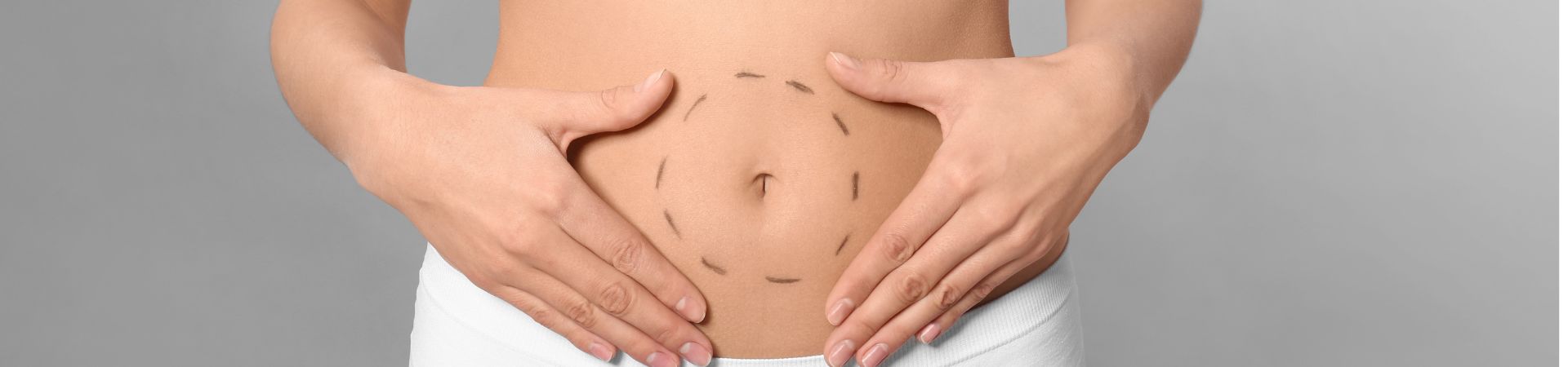 Person's abdomen with hands on either side, surrounding the navel. Dotted markings encircle the navel, hinting at a potential tummy tuck procedure.