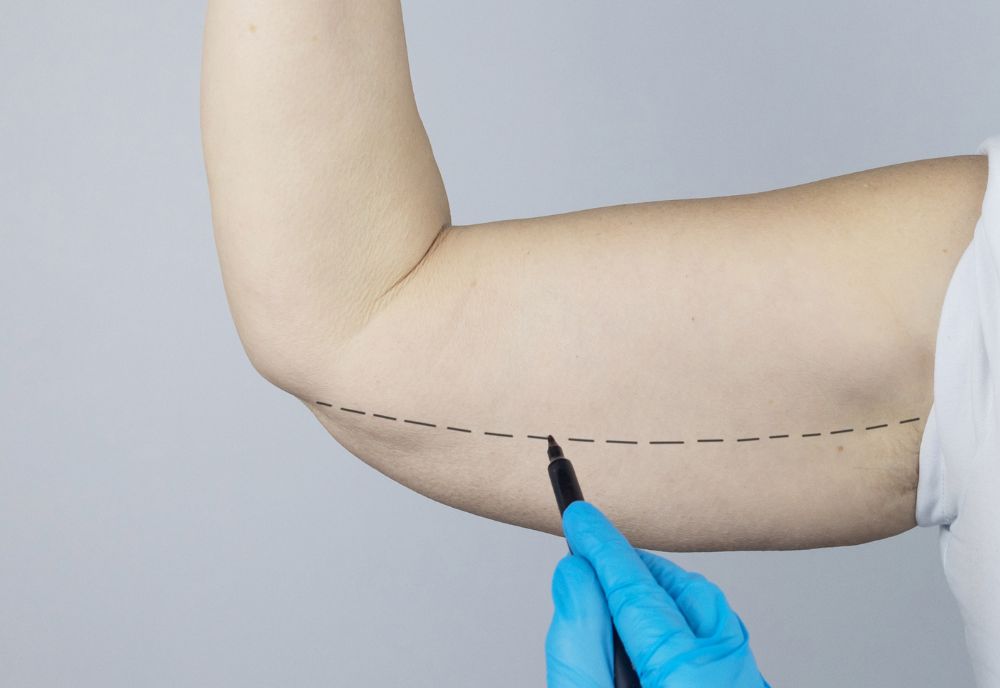 A person's arm features a dashed line, possibly marking for cosmetic procedures. A gloved hand holds a marker near the line, preparing for surgery.