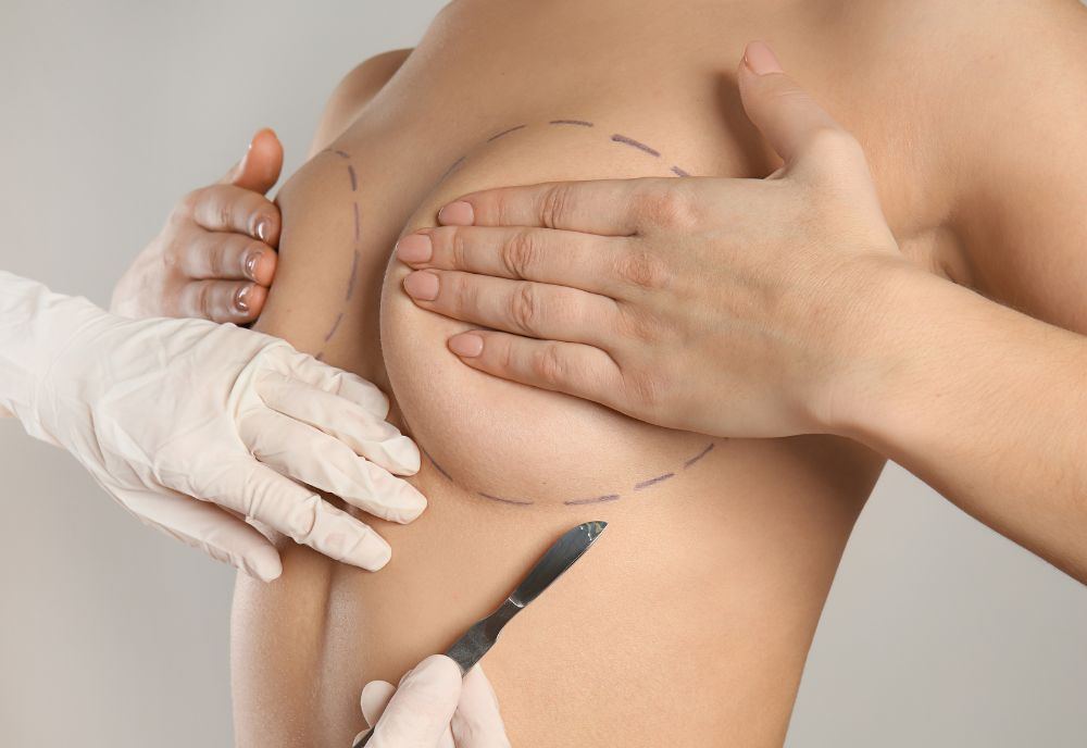 A person is preparing for breast surgery with circular markings, assisted by gloved hands holding a scalpel, as part of cosmetic procedures on Long Island.