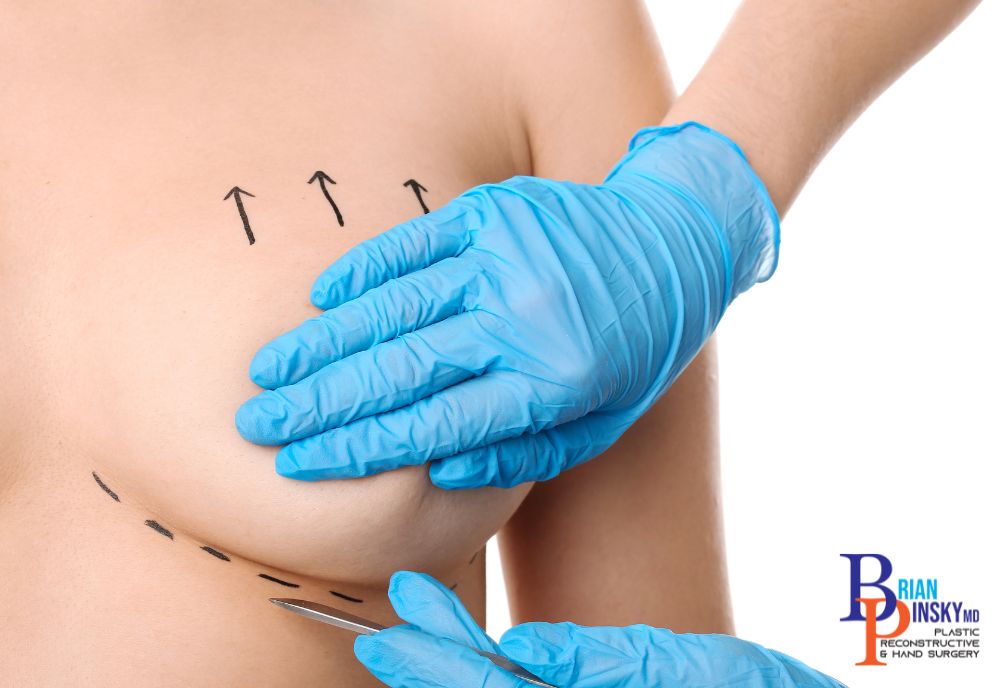 A person with marked lines on their skin, wearing blue surgical gloves, holds a scalpel in preparation for a breast augmentation procedure in Long Island.