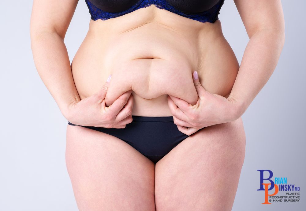 Person in dark underwear pinching their abdominal skin, perhaps contemplating a tummy tuck. On Long Island, plastic surgery offers various solutions for those seeking to refine their silhouette.