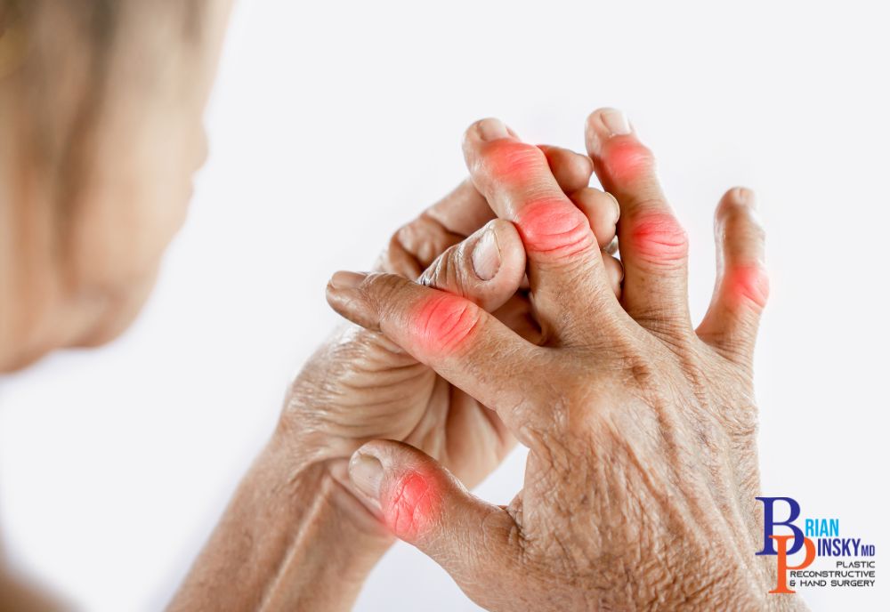 An elderly person is holding hands with red marks on the joints, indicating inflammation or pain. In Long Island, various treatments are available to alleviate discomfort and improve quality of life.