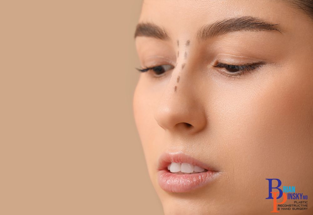 A woman's face in profile, adorned with dotted lines on her nose, hints at the potential for cosmetic procedures.