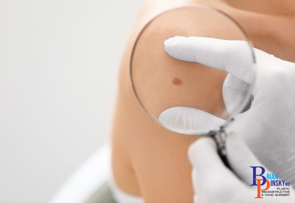 A gloved hand expertly holds a magnifying glass, scrutinizing a mole on the person's shoulder with precision, highlighting the importance of accurate assessments in cosmetic procedures.